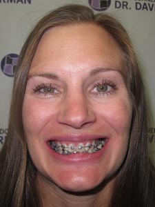 farmington orthodontist