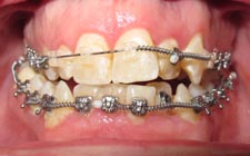 farmington orthodontist