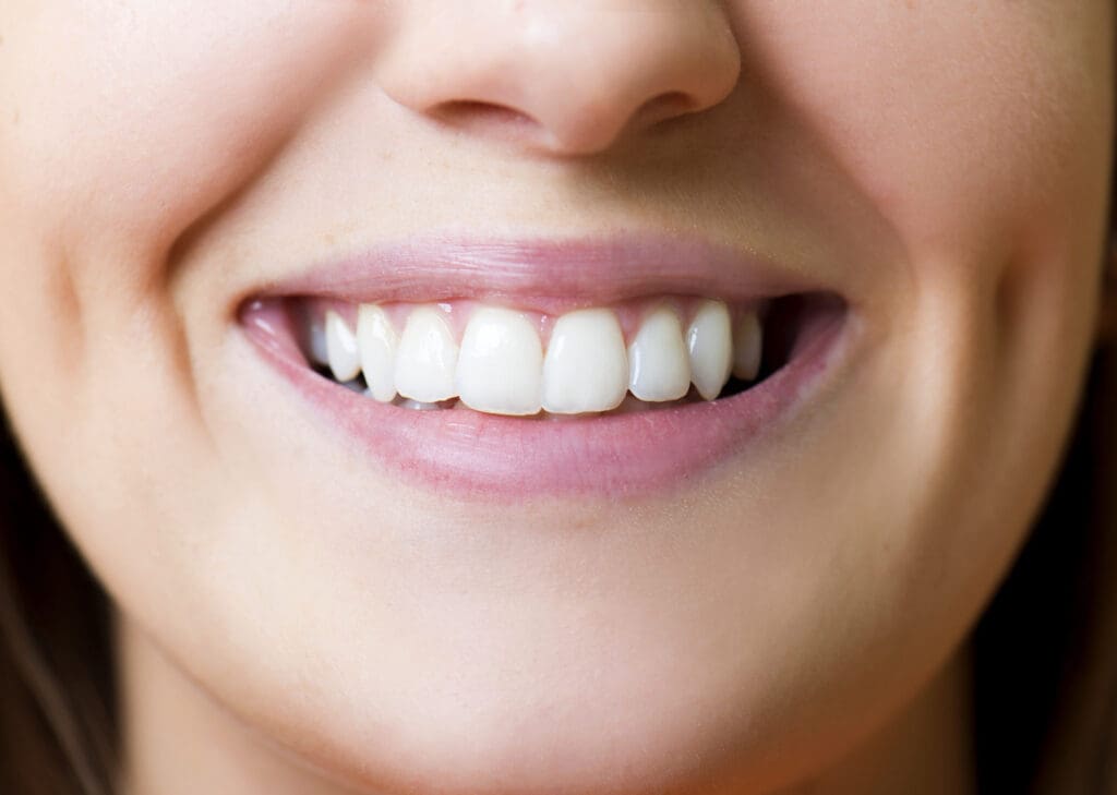 orthodontics | Why Braces Are A Great Investment