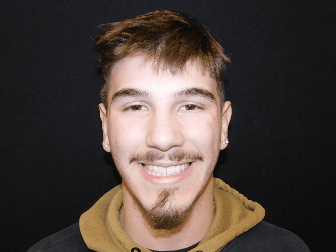 Tony - After Orthodontic Treatment