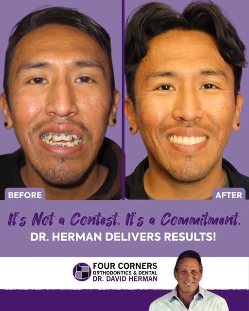 From Consultation to Treatment: The Step-by-Step Process of Getting Pitts21 Braces