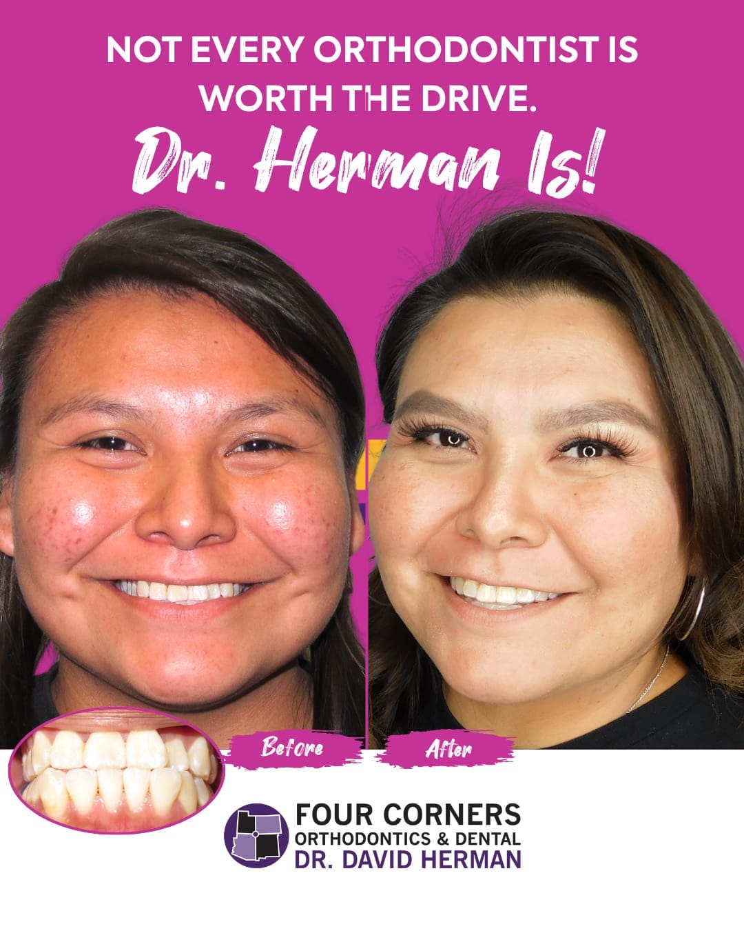 Smiling before-and-after orthodontic photos show improved teeth alignment. Text reads, "Not Every Orthodontist Is Worth The Drive. Dr. Herman Is!"